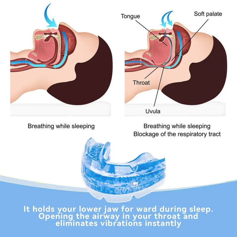 😴 SleepGuard - Protetor Bucal Ajustável Anti-Ronco 💤 | Sono Tranquilo e Revigorante!